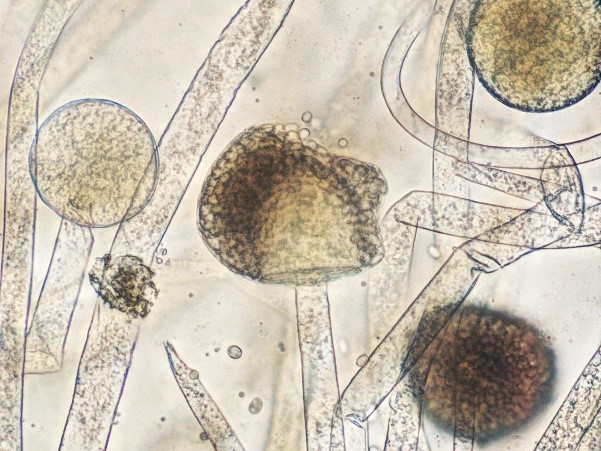 Обнаружены споры и мицелий. Грибы рода Mucor. Грибы рода Mucor микробиология. Плесневые грибы ризопус. Мукор ризопус.